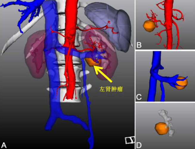 国产福利一区二区三区在线视频