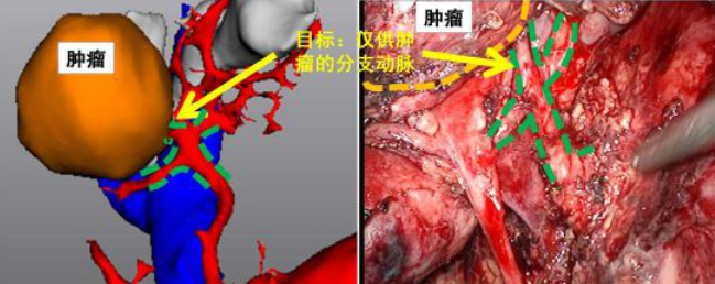 国产福利一区二区三区在线视频