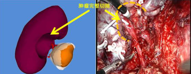 国产福利一区二区三区在线视频