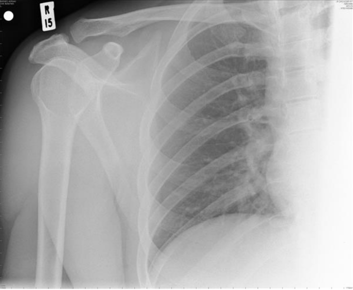 国产福利一区二区三区在线视频